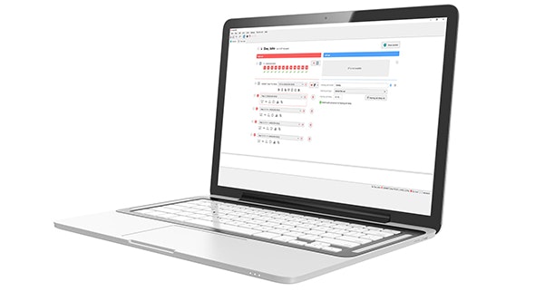 A laptop displays MAESTRO 11’s bimodal synchronization screen where clinicians can easily match the processing delay timing between some MED-EL audio processors and any hearing aid.