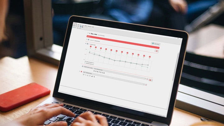 A laptop with the MAESTRO 11 software displays impedance field telemetry data gathered via Remote Care.