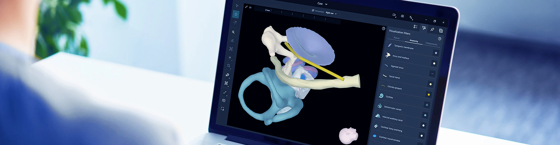 OTOPLAN Software