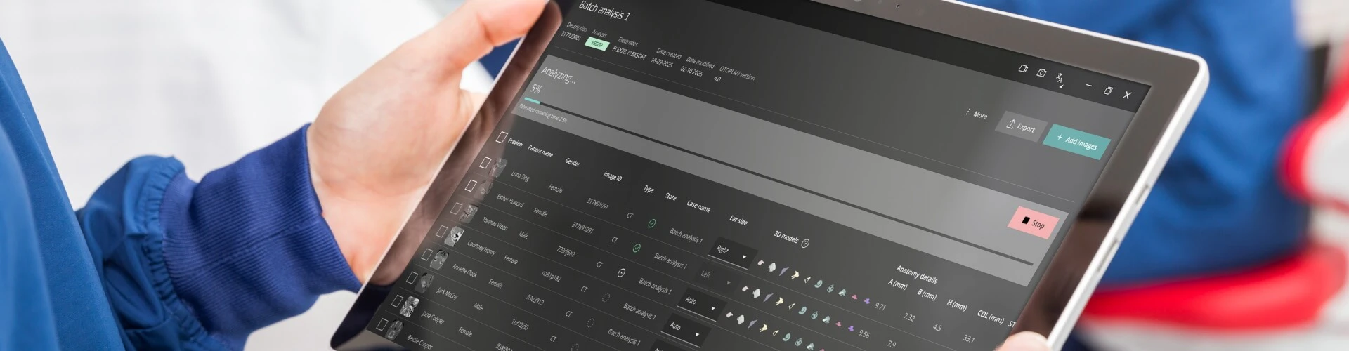 OTOPLAN Software