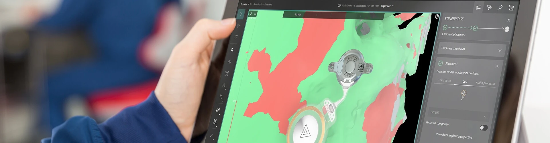 OTOPLAN Software