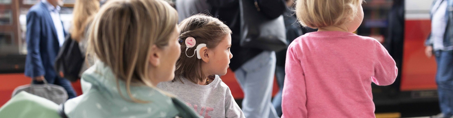 Bimodal Hearing With a Cochlear Implant and a Hearing Aid