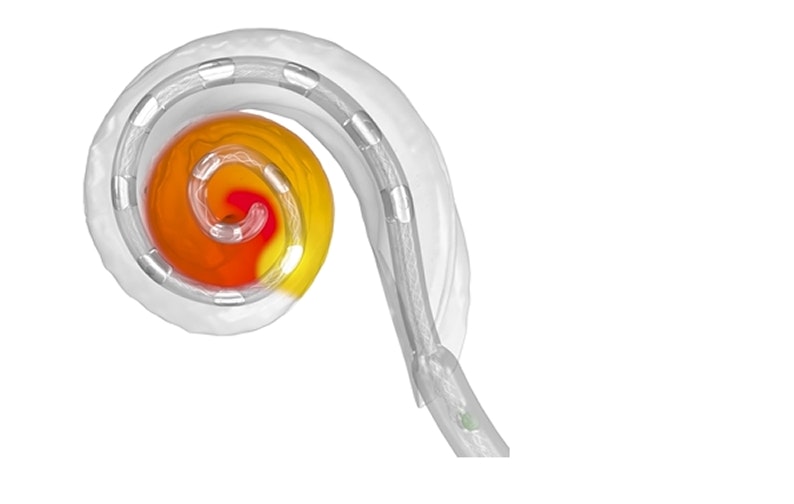 Darstellung einer Cochlea