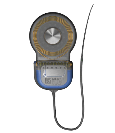 Top view of the SONATA 2 cochlear implant with electrode
