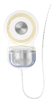 SONATA 2 cochlear implant with electrode array
