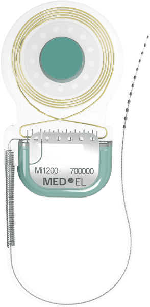 SYNCHRONY implant size