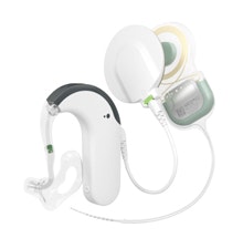 ระบบไฟฟ้าอะคูสติก