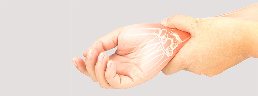 Causes of carpal tunnel syndrome