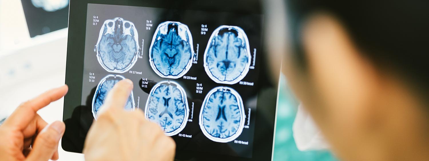 Diagnosis of infantile cerebral palsy