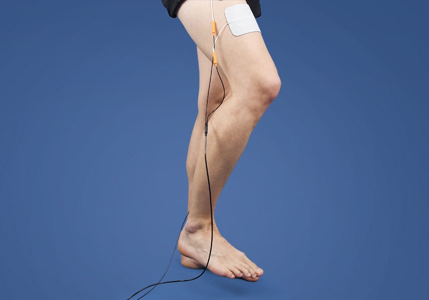 Functional electrical stimulation for the treatment of ataxia