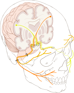 Forms of facial paralysis