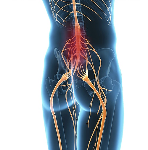 Symptoms of tetraplegia